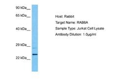 RAB6A Antibody, Novus Biologicals 100 &mu;L; Unconjugated:Antibodies, Polyclonal